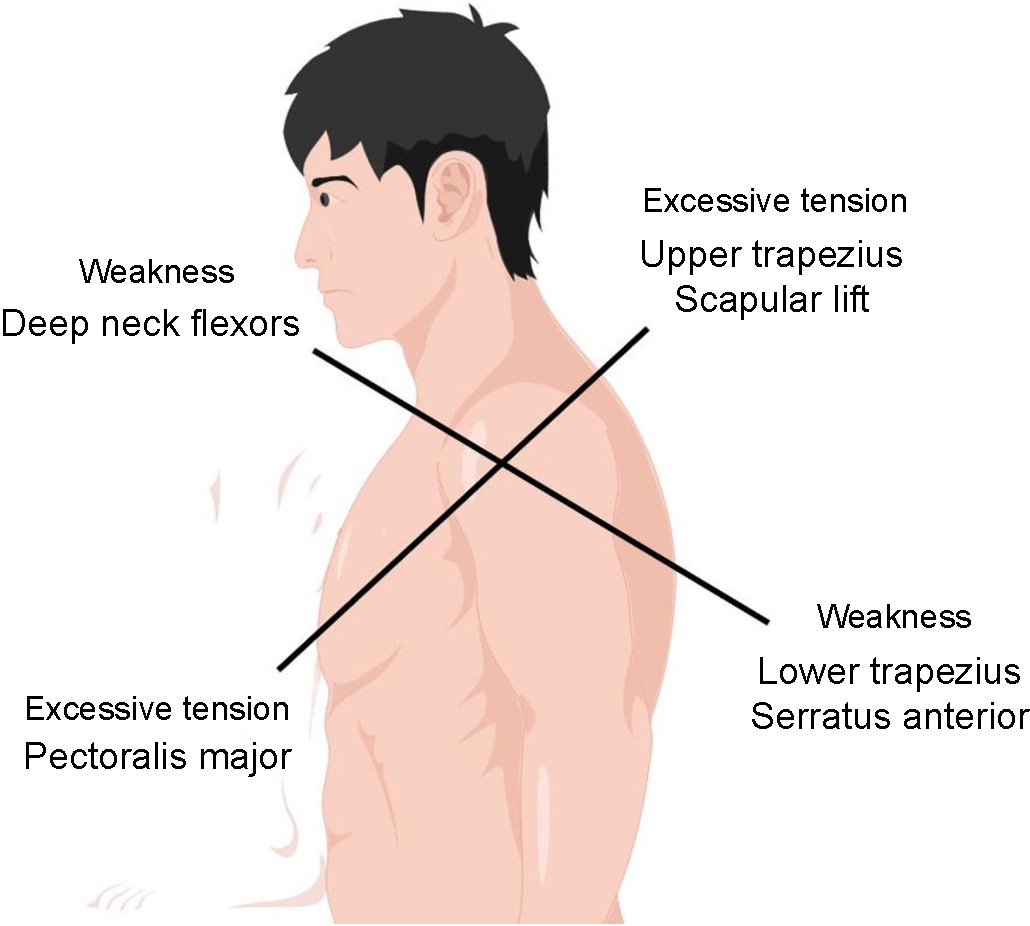 Traditional Physiotherapy Interventions for Pain Conditions