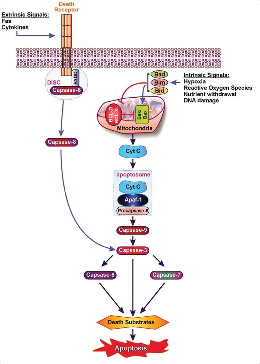 Apoptosis In Pancreatic B Islet Cells In Type 2 Diabetes Bosnian Journal Of Basic Medical Sciences