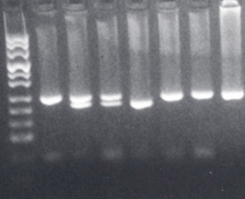 Frequency of CCR5Δ32 allele in healthy Bosniak population.