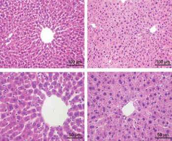 Glutathione protects against hepatic injury in a murine model of primary Sjögren’s syndrome