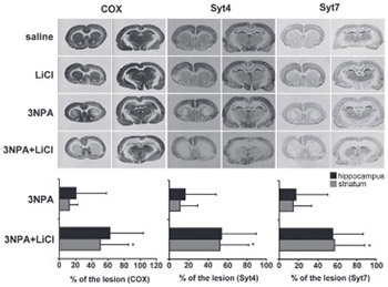 Lithium chloride could aggravate brain injury caused by 3-nitropropionic acid