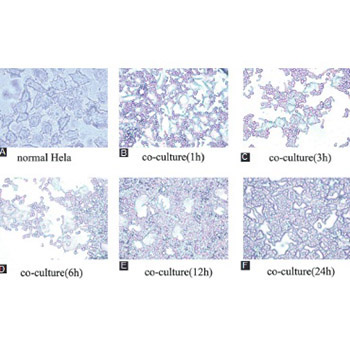 Time course of global gene expression alterations in Candida albicans during infection of HeLa cells