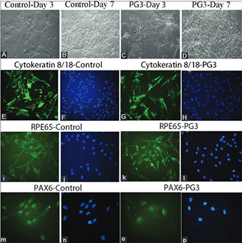 The effects of platelet gel on cultured human retinal pigment epithelial (hRPE) cells