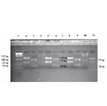 Association of Mannose-Binding Lectin 2 (mbl2) gene heterogeneity and its serum concentration with osteoporosis in postmenopausal women