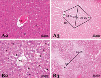 The protective effect of diosmin on hepatic ischemia reperfusion injury: an experimental study