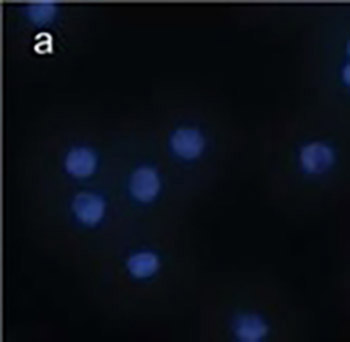 Activation of M1 mAChRs by lesatropane rescues glutamate neurotoxicity in PC12 cells via PKC-mediated phosphorylation of ERK1/2