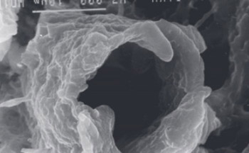 Pathologic morphology of acute experimental osteomyelitis