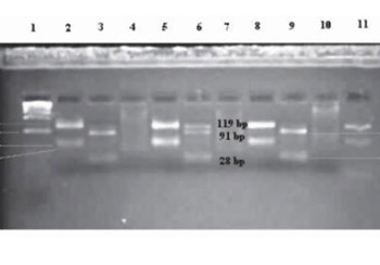 Association of dopamine receptor gene polymorphism and psychological personality traits in liability for opioid addiction