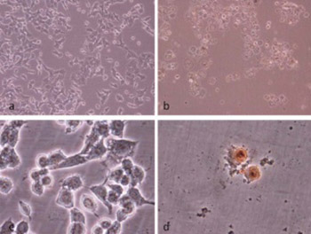 Induction of apoptosis by grape seed extract (Vitis vinifera) in oral squamous cell carcinoma