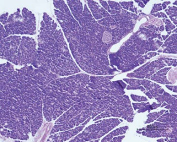 The influence of chronic intake of saccharin on rat hepatic and pancreatic function and morphology: gender differences