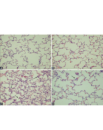 Dexmedetomidine reduces ventilator-induced lung injury (VILI) by inhibiting Toll-like receptor 4 (TLR4)/nuclear factor (NF)-κB signaling pathway