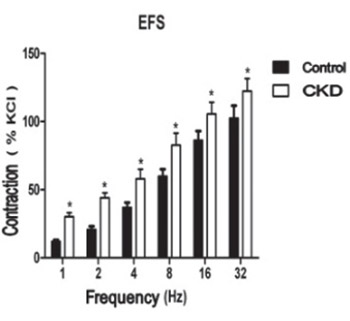 Contractile responses of urinary bladder in an experimental model of chronic renal failure