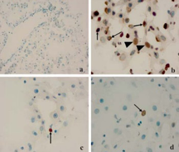 The effects of Crataegus aronia var. dentata Browicz extract on biochemical indices and apoptosis in partially hepatectomized liver in rats