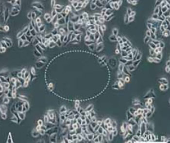 Different effects of sonoporation on cell morphology and viability