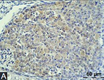 Trefoil factor family peptides TFF1 and TFF3 in the nervous tissues of developing mouse embryo