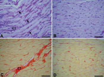 Glycogen accumulation in cardiomyocytes and cardiotoxic effects after 3NPA treatment