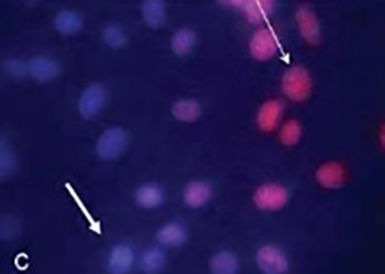 Possible involvement of calcium channels and plasma membrane receptors on Staurosporine-induced neurite outgrowth