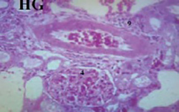 Effect of high saturated free fatty acids feeding on progression of renal failure in rat model of experimental nephrotoxicity