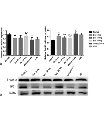 Berberine alleviates oxidative stress in rats with osteoporosis through receptor activator of NF-kB/receptor  activator of NF-kB ligand/osteoprotegerin (RANK/RANKL/OPG) pathway
