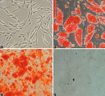 Upregulation of miR-210 promotes differentiation of mesenchymal stem cells (MSCs) into osteoblasts
