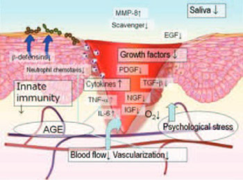 The Mechanism of Protracted Wound Healing on Oral Mucosa in Diabetes. Review