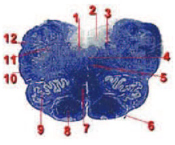 In Vitro Research of the Alteration of Neurons in Vagal Core in Medulla Oblongata at Asphyxic Deaths