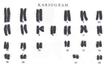 The Impact of Rituximab Therapy on the Chromosomes of Patients with Rheumatoid Arthritis