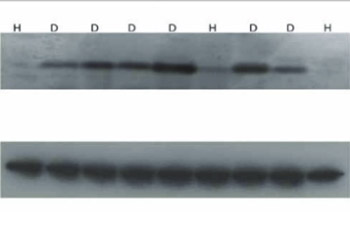 Chromogranin A Detection in Saliva of Type 2 Diabetes Patients