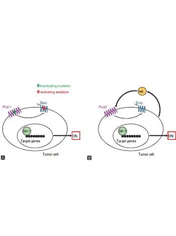 The role of the Hedgehog signaling pathway in cancer: A comprehensive review