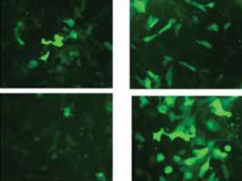 Comparative Analysis of Gene Transfer to Human and Rat Retinal Pigment Epithelium Cell Line by a Combinatorial Use of Recombinant Adeno- Associated Virus and Ultrasound or/and Microbubbles