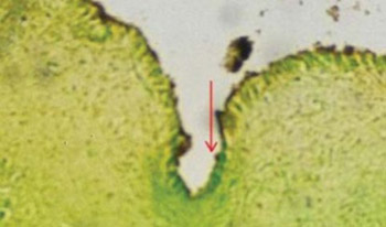 In Vitro Examination of Ontogenesis of Developing Neuronal Cells in Vagal Nuclei in Medulla Oblongata in Newborns