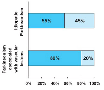 Doppler Sonography Characteristics of Vertebrobasilar Circulation In Patients With Parkinson’s Disease