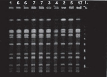 Epidemiologic Genotyping of Methicillin-Resistant Staphylococcus aureus (MRSA) by Pulsed-Field Gel Electrophoresis (PFGE)