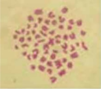 Research on Spontaneously Emerged Chromosomal Aberrations in the Periphery Blood Lymphocytes in Cattle (‘Buša’ Breed)