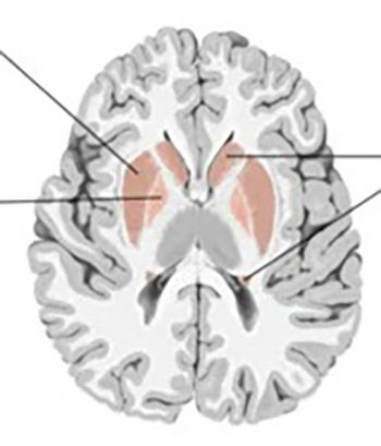 Registration and Analysis of Bioelectric Activity of Sensory-Motor Cortex During the Electrical Stimulation of Nucleus Caudate in Rats