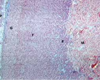 The Role of Pineal Gland and Exogenous Melatonin on the Irradiation Stress Response of Suprarenal Gland