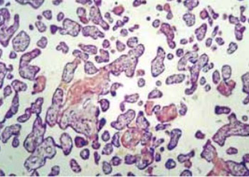 Stereological Analysis of Mature Human Placenta of Pregnant Women of Different Age