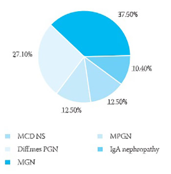 Treatment aspects of primary nephrotic syndrome in adults