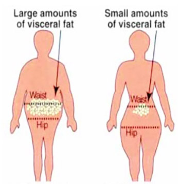 Obesity biological and psychological aspect