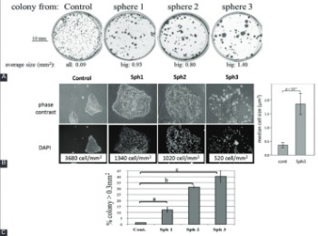 Induction of epithelial-mesenchymal transition (EMT) and Gli1 expression in head and neck squamous cell carcinoma (HNSCC) spheroid cultures