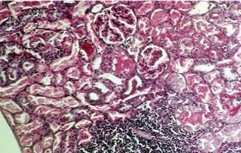 Nitric Oxide in Gentamicin-induced Acute Tubular Necrosis in Rats