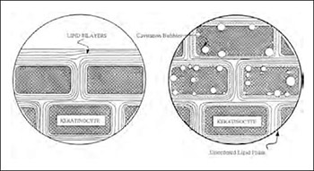 Sonophoresis-mechanisms and application