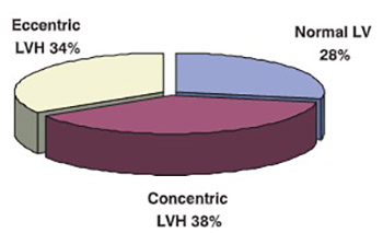 Left ventricular hypertrophy and risk factors for its development in uraemic patients