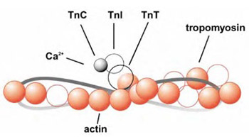 Cardiac troponin I: the gold standard in acute myocardial infarction diagnosis