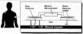 Iontophoresis: fundamentals, developments and application