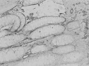 Type IV collagen immunoreactivity of basement membrane in inflammatory-regenerative and dysplastic lesions of the flat colonic mucosa