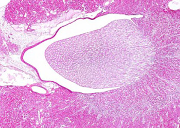 Proximal convoluted tubules of the rats kidney--a stereological analysis