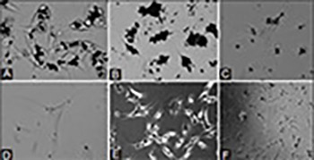 The effect of micro-sized titanium dioxide on WM-266-4 metastatic melanoma cell line