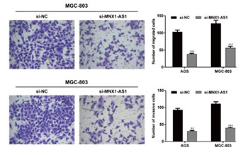 Upregulated expression of MNX1-AS1 long noncoding RNA predicts poor prognosis in gastric cancer