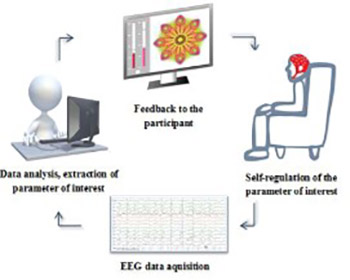 Review of the therapeutic neurofeedback method using electroencephalography: EEG Neurofeedback